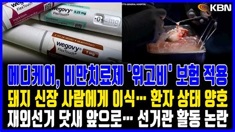 미동부 최대 한인방송 재외선거 닷새 앞으로 재외선거관 활동 논란 메디케어 파트d 비만치료제 보험 적용 돼지 신장