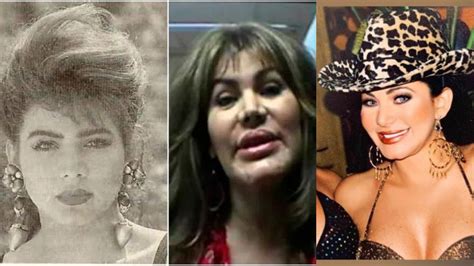 Así Fue Como El Rostro De Lady Noriega Se Desfiguró Por Culpa De Los