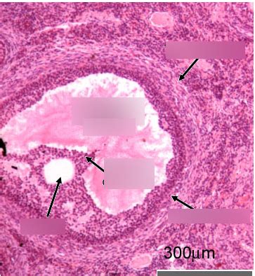 Diagram Of Histology Of Graafian Follicle Labelled Quizlet