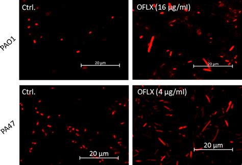 Efficacy Of Levofloxacin Against Biofilms Of Pseudomonas Aeruginosa