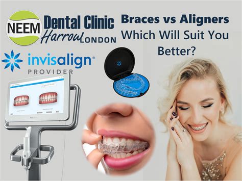 Braces Vs Aligners — Which Will Suit You Better By Emergency Dentist