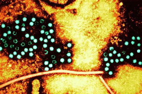 Hepatitis E Virus Particles Photograph By Cdcscience Photo Library