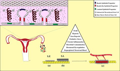 The Pathogenesis Of Endometriosis A Stem Cells Of The Eutopic