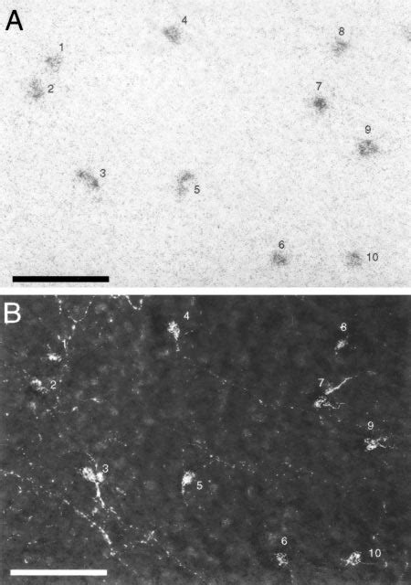 Melanopsin Is Colocalized With Pacap In Retinal Ganglion Cells A