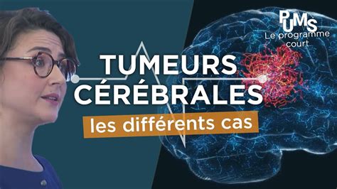 Est Ce Quune Tumeur Au Cerveau Est Grave Les Diff Rentes Tumeurs