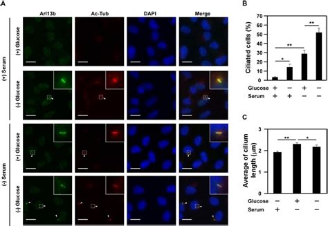 Figure 1 From Glucose Deprivation Induces Primary Cilium Formation