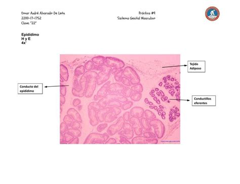 Sistema Genital Masculino Omar Alvarado De León uDocz