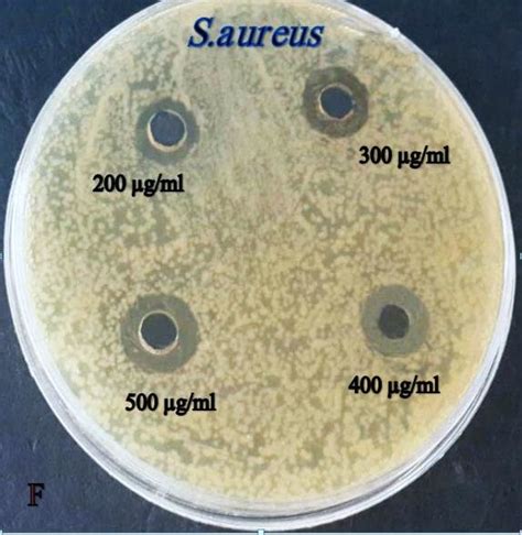 Antibacterial Activity Of Silver Nanoparticles Against A Li