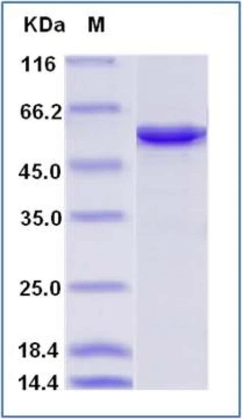 Sino Biological Human Srp Protein His Tag Ug Quantity Each Of