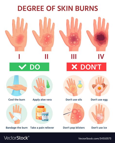 Burns Degree First Aid For Burn Wound Fire Vector Image