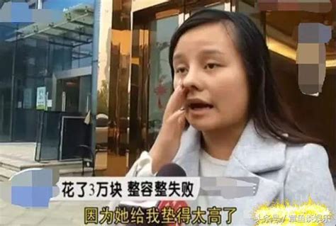 女子花3萬整鼻子，卻被同事嘲笑，醫院：鼻子很漂亮，五官配不上 每日頭條