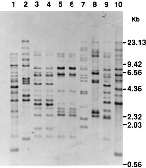 Hybridization Of Digoxigenin Labeled CARE 2 DNA Probe To Eco RI