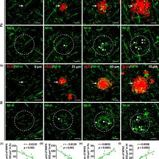 NeuNpositive neuronal loss is correlated with the size of Aβ deposits