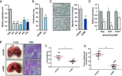 Stable Knockdown Of Gal 3BP Suppresses PDAC Metastasis In Mouse