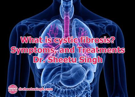 What Is Cystic Fibrosis Symptoms And Treatments Dr Sheetu Singh