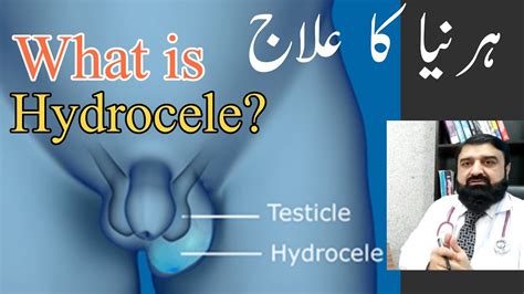 What Is Hydrocele Types And Causes Of Hydrocele Treatment Of