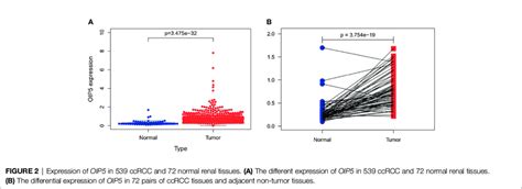 C Showed Different Patterns Of Infiltrating Immune Cells In Ccrcc