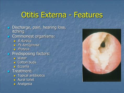 Otitis Externa Causes