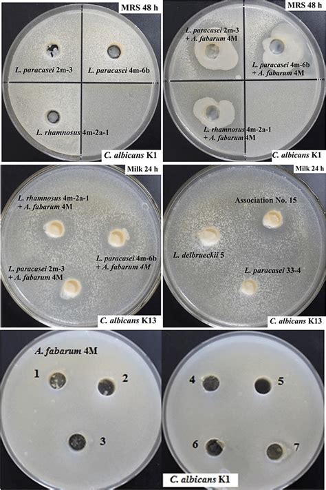 Inhibition Of C Albicans Growth With Separate Cultures And Download Scientific Diagram