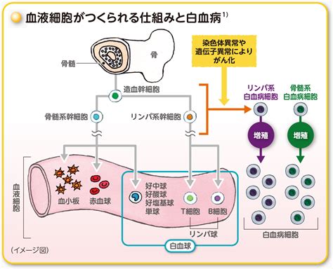 白血病の発生と種類 急性骨髄性白血病（aml） ベネクレクスタjp アッヴィ