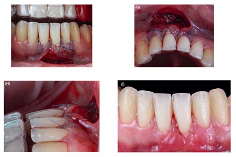 Applied Sciences Free Full Text Clinical Outcomes Of The Double