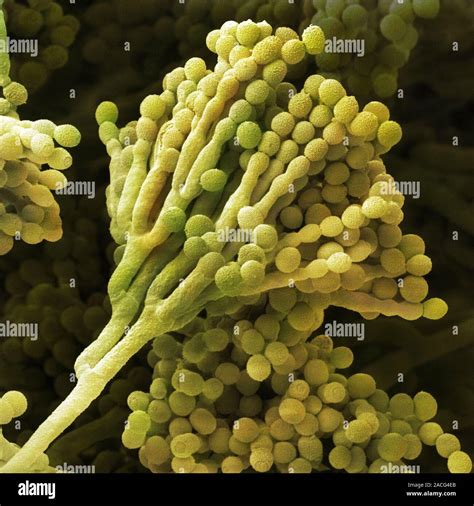 Mould Fungus Penicillium Expansum Coloured Scanning Electron