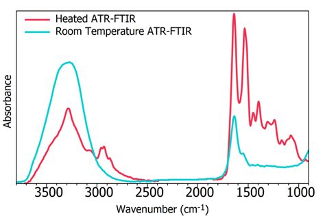 ATR FTIR Blood Serum Analysis Blood Spectroscopy