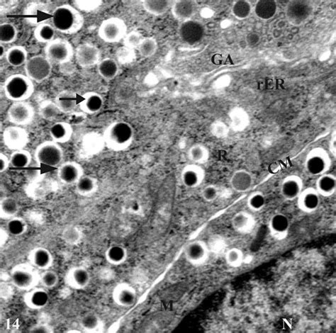 An electron micrograph of a part of islet of Langerhans of S.... | Download Scientific Diagram