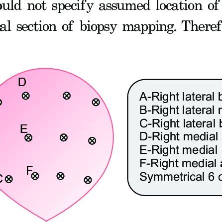 Locations Of Standard Core Transrectal Ultrasonography Guided