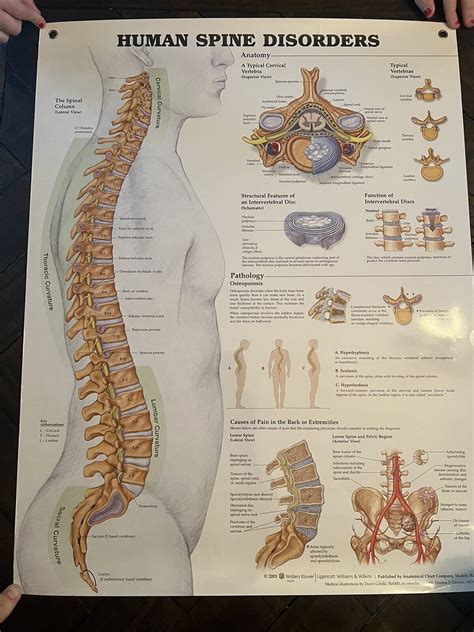 Human Spine Disorders Laminated Wall Chart-Poster-Home School-New w ...