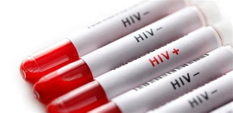 Kampf Gegen Aids Droht Laut Experten Zu Scheitern Life Heute At