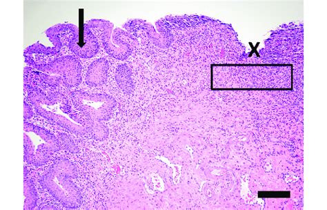 Histopathology The Mucosa Arrow Of The Urinary Bladder Is