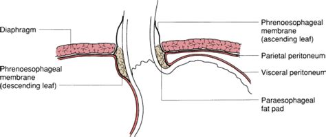 Esophageal Anatomy and Physiology and Gastroesophageal Reflux Disease ...