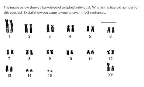 Solved The image below shows a karyotype of a diploid | Chegg.com