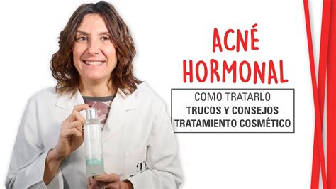 AcnÉ Hormonal Tratamiento Cosmético Y Natural Youtube