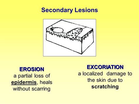 Skin Erosion Histology