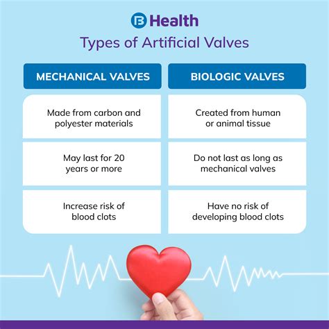 Replacement of Valve in Heart: 4 Types of Valve Replacement Surgery ...