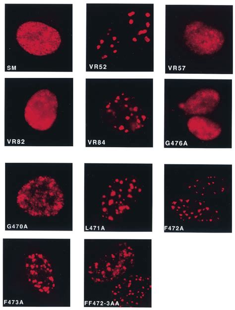 Nuclear Localization Of Wild Type SM And Carboxy Terminal Mutant SM