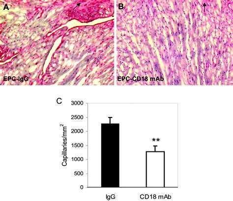 Essential Role Of ICAM 1 CD18 In Mediating EPC Recruitment