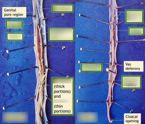 Roundworm Internal Anatomy Diagram | Quizlet