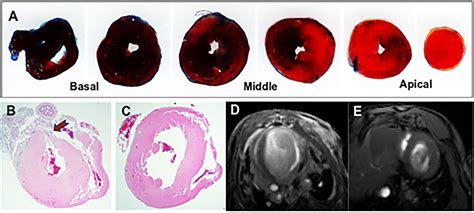 Frontiers Modified Gan Augmentation Algorithms For The Mri