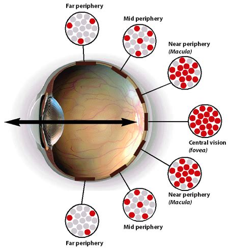 Peripheral blurred vision one eye: 11 Causes of Blurry Vision in One Eye