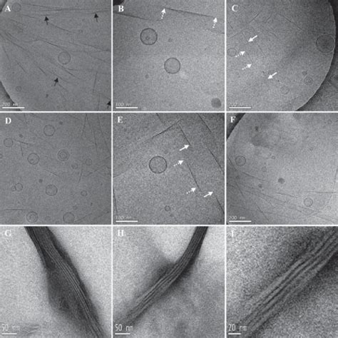 A Selection Of Cryo Tem Panels A F And Ns Tem Panels G I