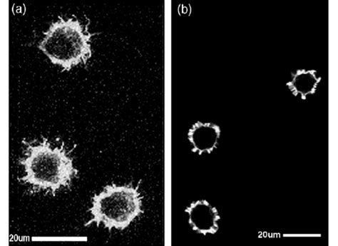 Confocal Laser Scanning Micrographs Of J774 Macrophages Cultured For 24