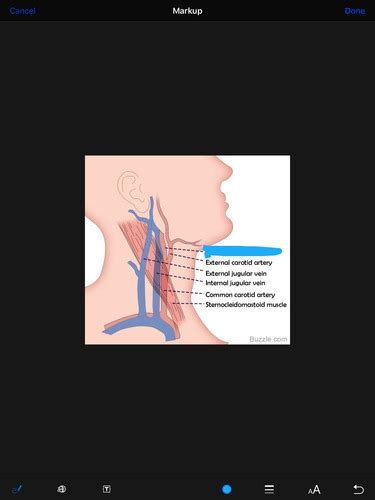 Head And Neck Flashcards Quizlet