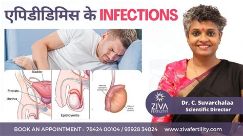 Epididymitis एपिडीडिमिस के Infections Male Infertility Dr C Suvarchalaa Ziva Fertilityy