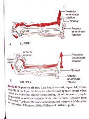 Long Sit Test