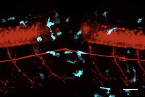 Becker Lab Crtdresden On Twitter In A Model Using Larval Zebrafish