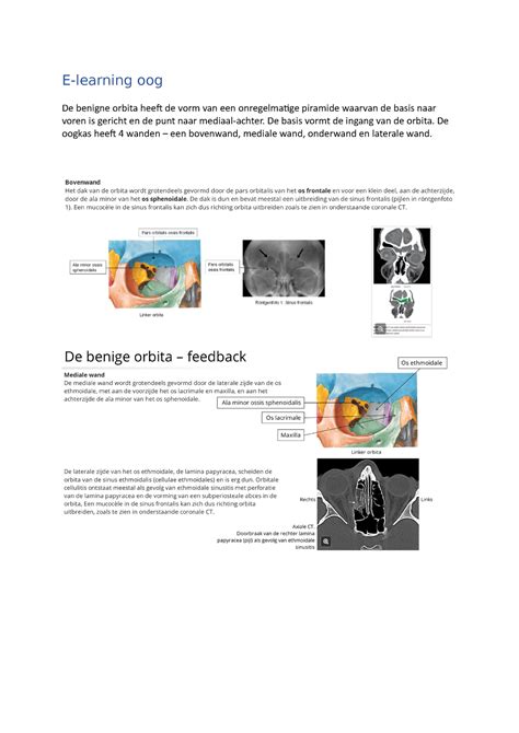 E Learning Oog Anatomie Oog E Learning Oog De Benigne Orbita Heeft