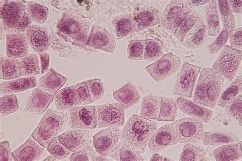 Metaphase Microscope